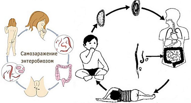 Пути заражения