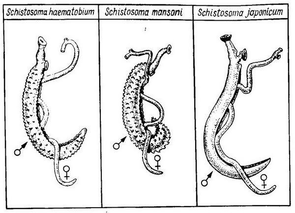Почему возникает шистосомоз?