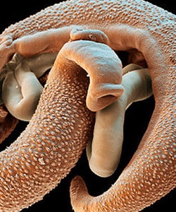 Виды паразитов в крови человека