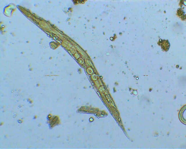 Стронгилоидоз: причины, симптомы и лечение