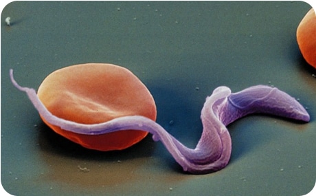 как выглядит возбудитель болезни