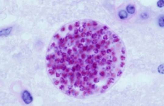 Паразит под микроскопом