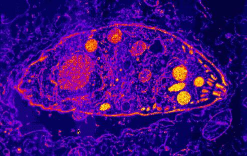 Токсоплазма