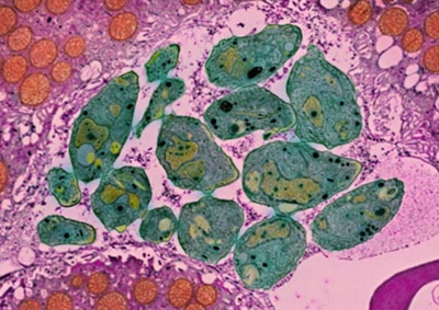 Какие кошачьи паразиты опасны для человека?