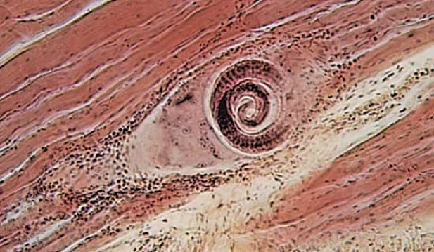 Как осуществляется проверка мяса на трихинеллез?