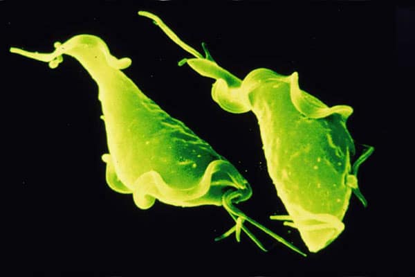 Отличие трихомониаза от гонореи: как выявить болезнь