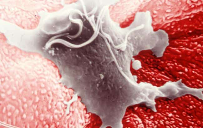 Почему развивается и как лечится трихомониаз у детей?