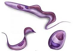 Как победить болезнь Шагаса: симптомы, диагностика, лечение