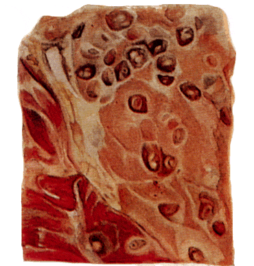 Зараженное мясо