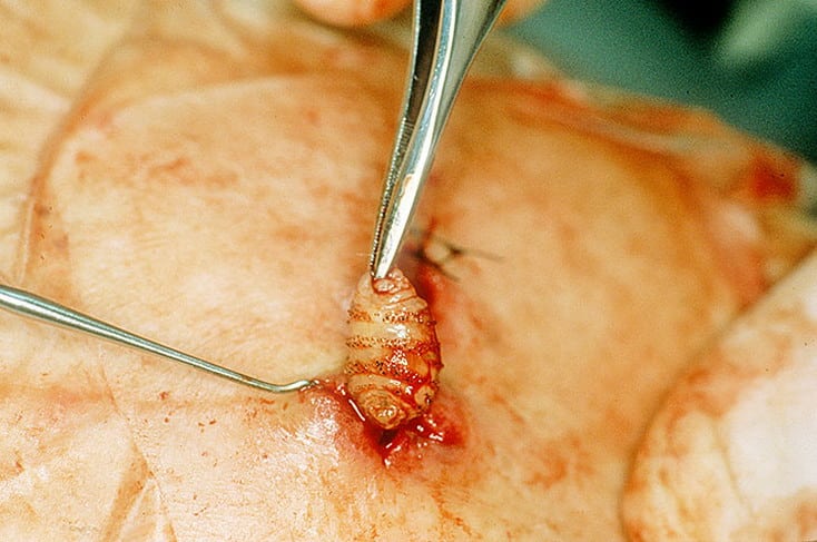 Что такое миазы у человека?