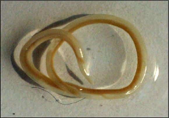 Чем вызывается и как передается анизакидоз?