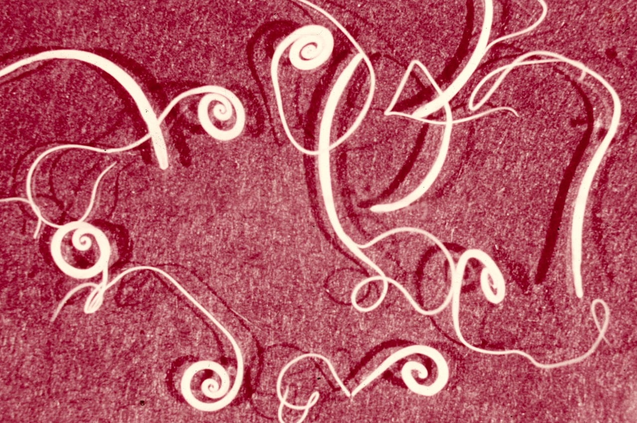 как выглядит паразит