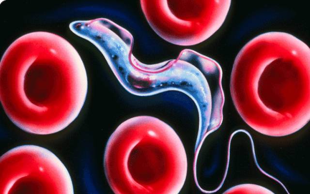 Почему возникает и как развивается сонная болезнь?