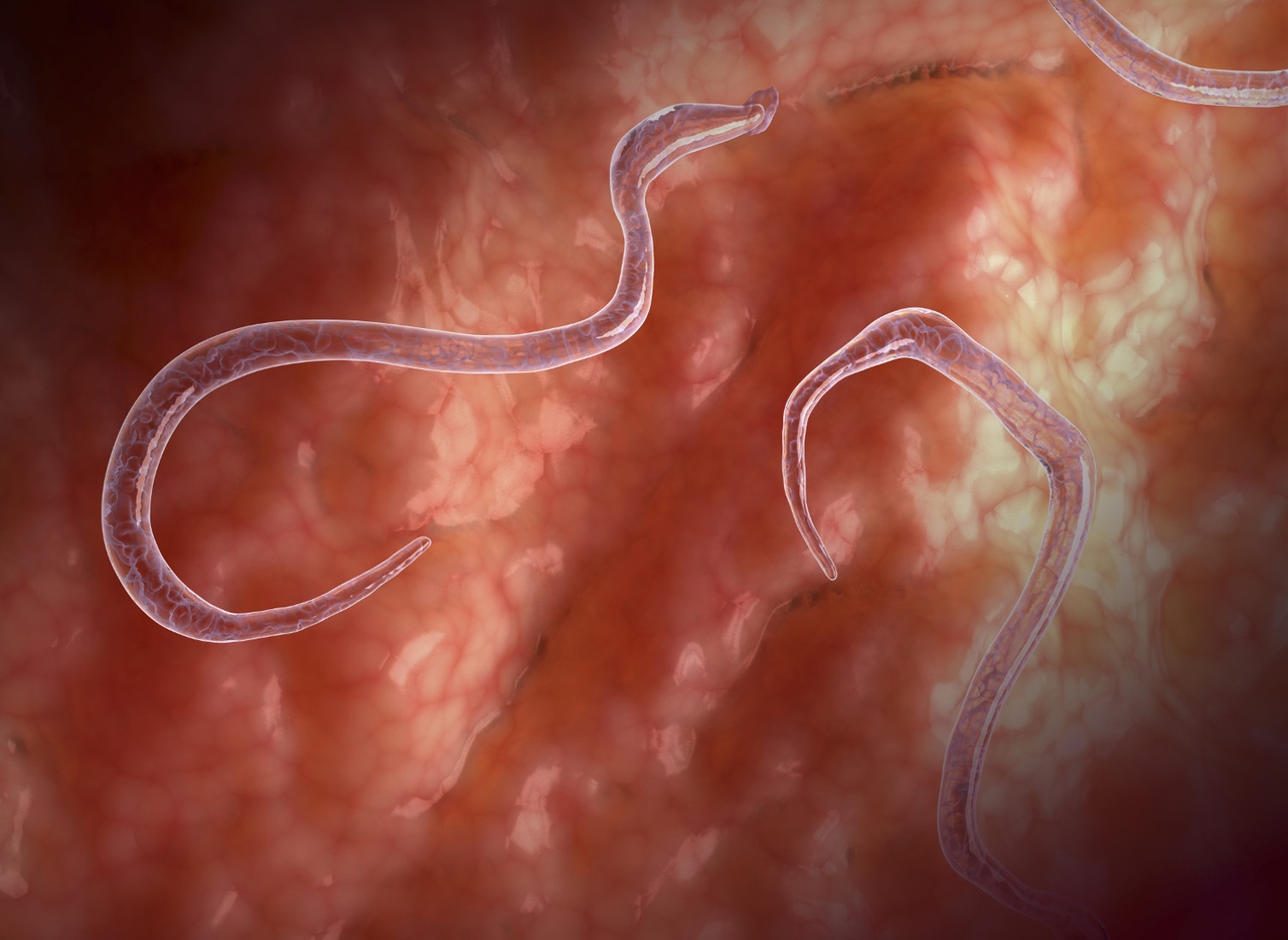 Виды паразитов и симптомы. Основные признаки наличия паразитов в организме