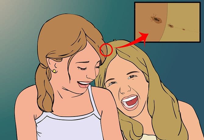 Где и как можно заразиться педикулезом?