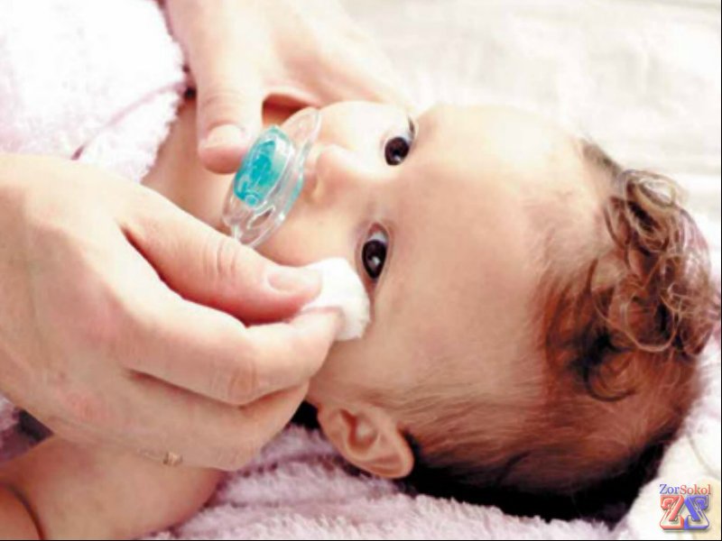 Глаза нужно слегка протирать Мирамистином Глаза нужно слегка протирать Мирамистином