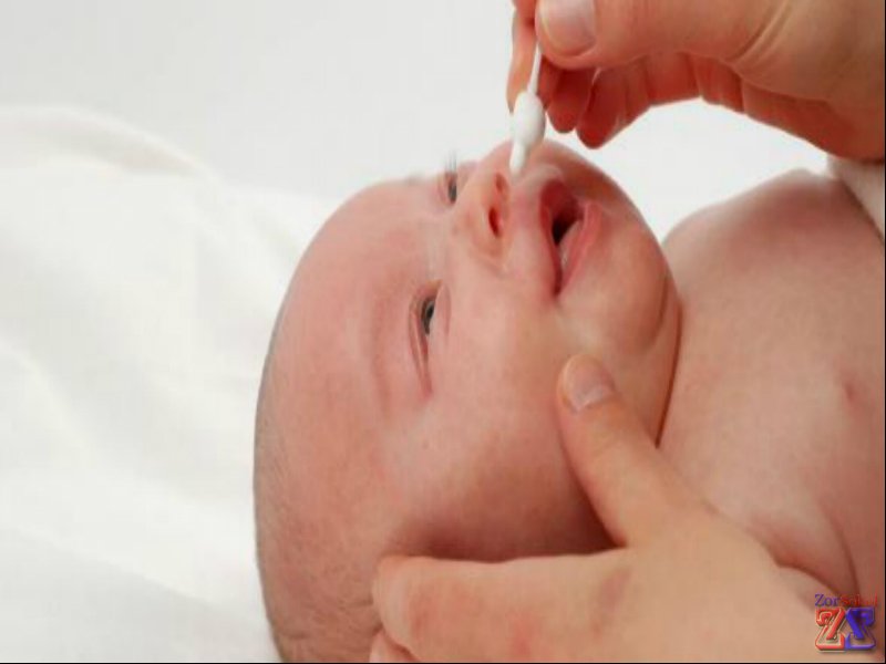 Назальное применение Альбуцида Назальное применение Альбуцида