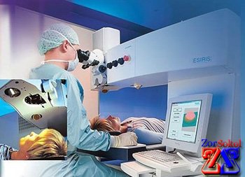 Операция по коррекции зрения Операция по коррекции зрения