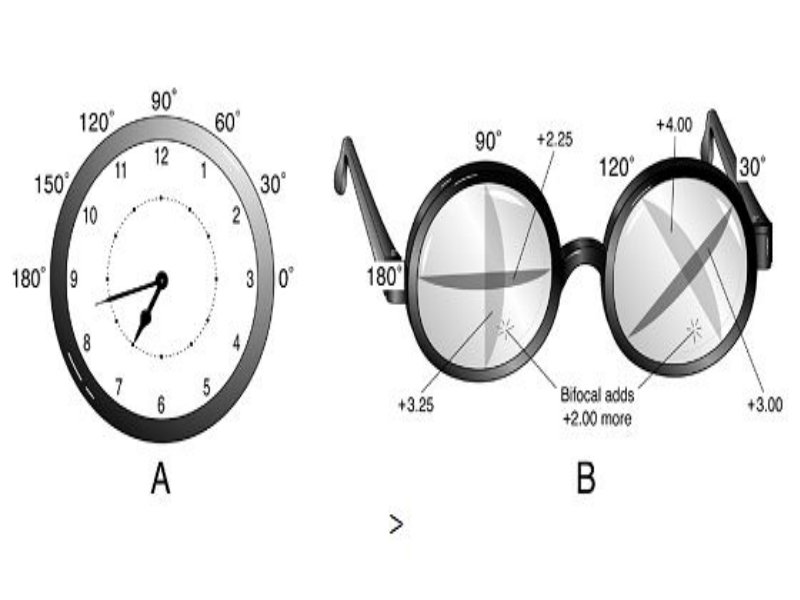Устройство бифокальных астигматических очков Устройство бифокальных астигматических очков
