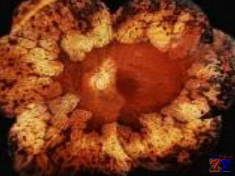 Снимок круговой атрофии сетчатки Снимок круговой атрофии сетчатки