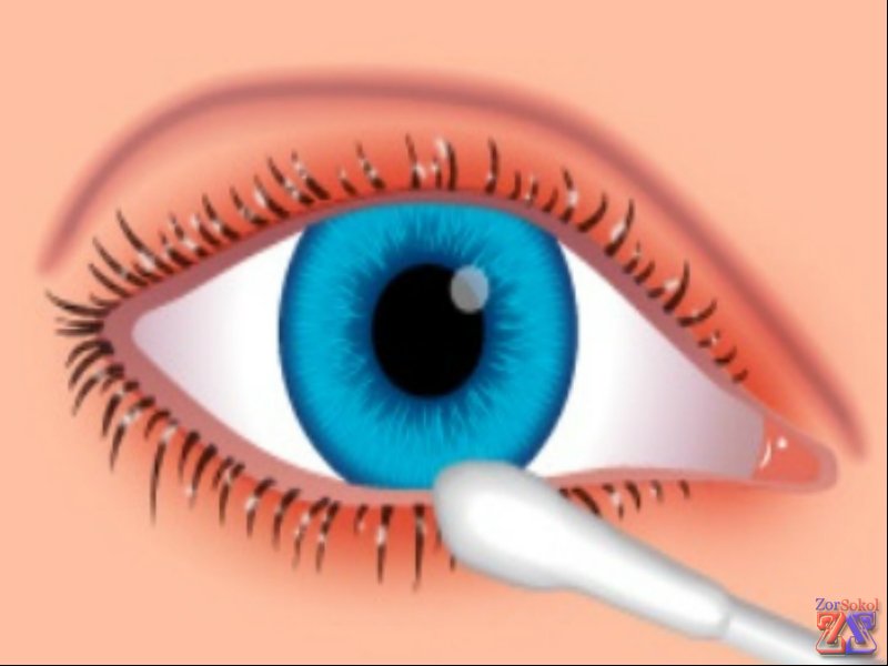 Мази наносятся аккуратно на краешки век Мази наносятся аккуратно на краешки век