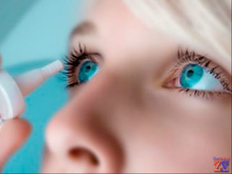 Линзы на время лечения желательно забыть Линзы на время лечения желательно забыть