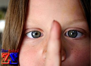 Основные причины косоглазия Основные причины косоглазия