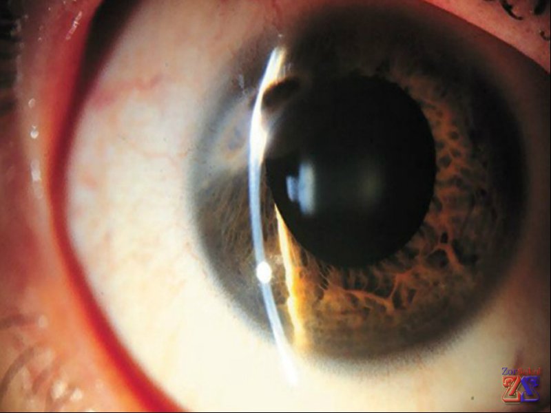 Дистрофии имеют общие признаки Дистрофии имеют общие признаки