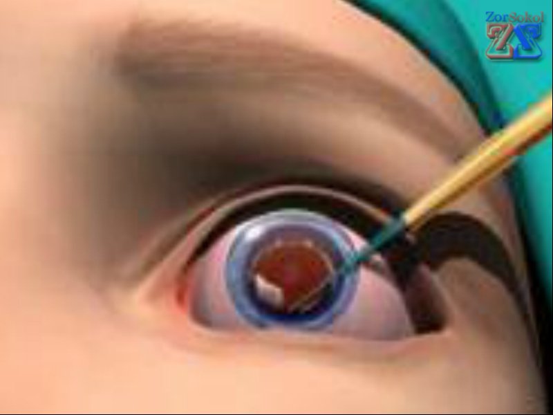 Этап 1 Этап 1