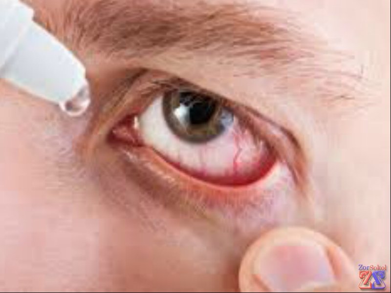 В глаза капают по 1 капле В глаза капают по 1 капле