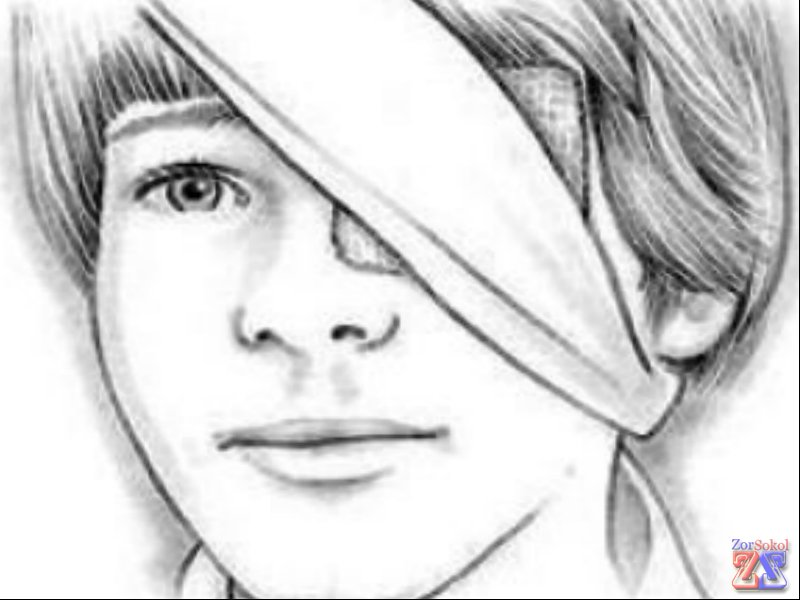 Причины развития глазных болезней разные Причины развития глазных болезней разные