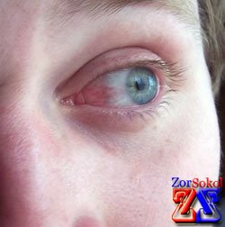 Начинайте лечение при первых признаках Начинайте лечение при первых признаках