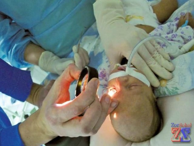 Первый осмотр офтальмологом Первый осмотр офтальмологом