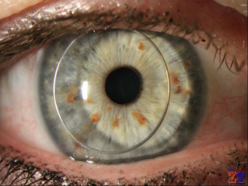 Осложнения возникают очень редко Осложнения возникают очень редко