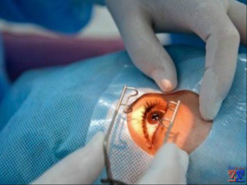 Одно из показаний - ингибирование сужения зрачка Одно из показаний - ингибирование сужения зрачка