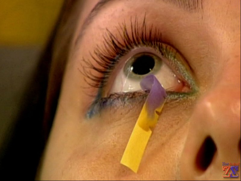 Одно из показаний - синдром сухого глаза Одно из показаний - синдром сухого глаза