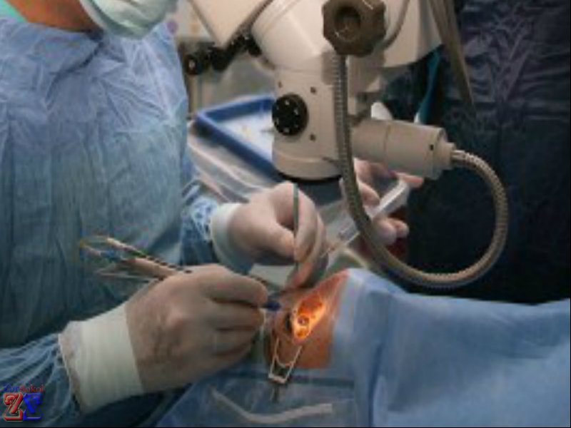 Где лучше лечат глаукому? Где лучше лечат глаукому?