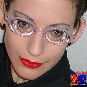 Сильная миопия - толстые линзы Сильная миопия - толстые линзы