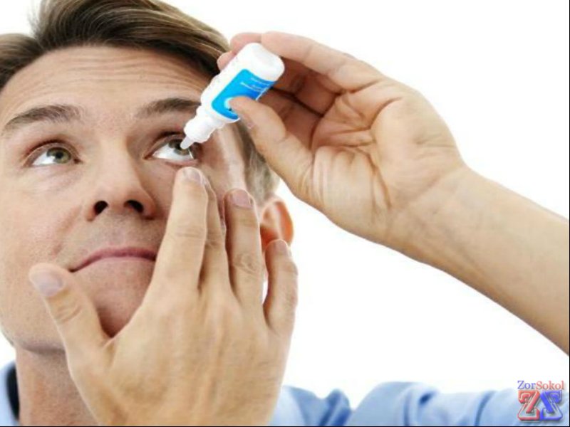 Могут быть назначены глазные капли Могут быть назначены глазные капли