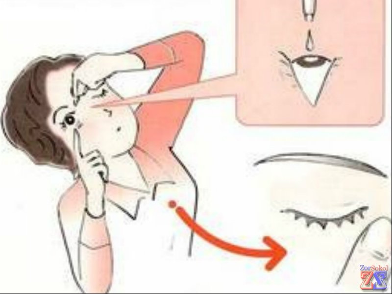 Капать 3 раза в день по 1 капле Капать 3 раза в день по 1 капле