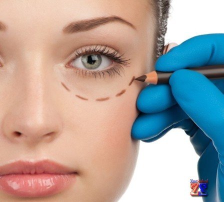 Радикальный метод избавления – блефаропластика Причины появления мешков вокруг глаз