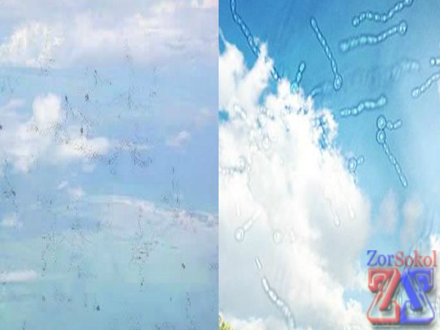 Мелькающие точки и ниточки Мелькающие точки и ниточки