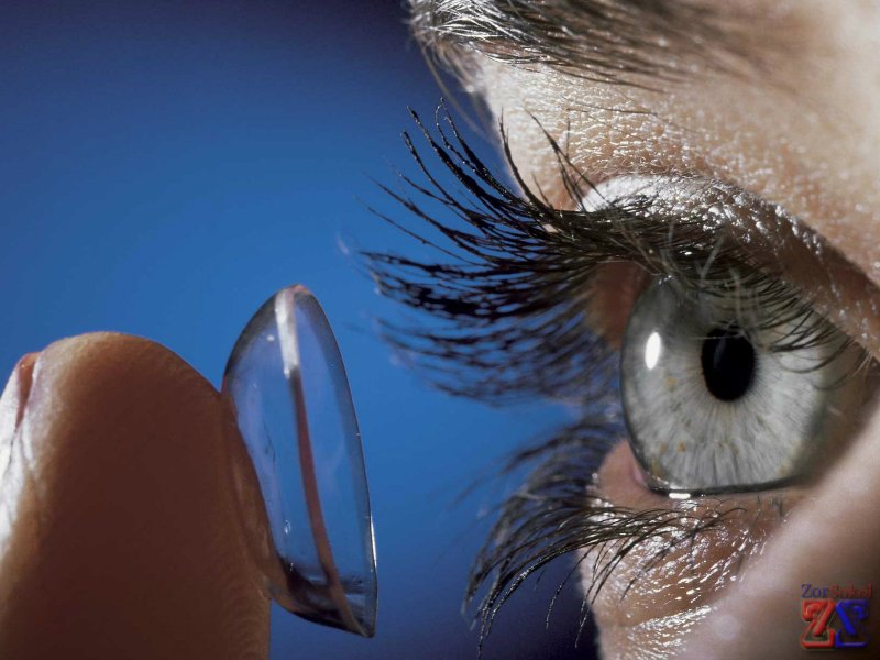 ОКЛ придают роговице правильную форму ОКЛ придают роговице правильную форму