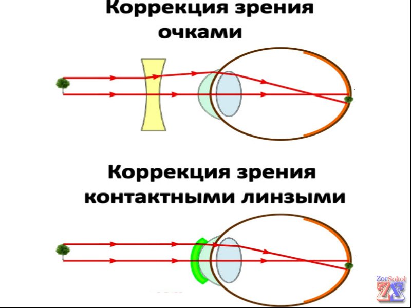 Преломление лучей очками и линзами Преломление лучей очками и линзами
