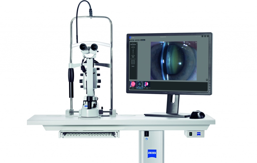 Осмотр щелевой лампой