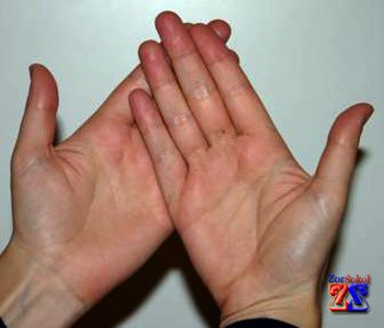 Позиция сложенных ладоней для пальминга Позиция сложенных ладоней для пальминга