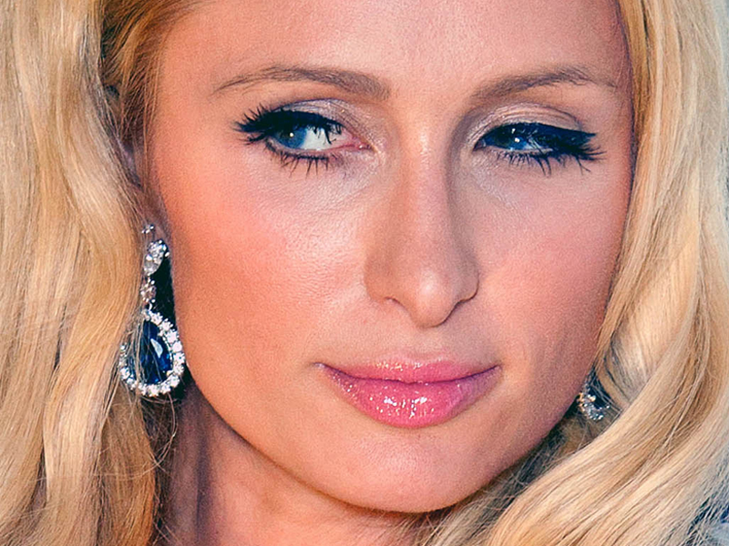 Птоз после ботокса