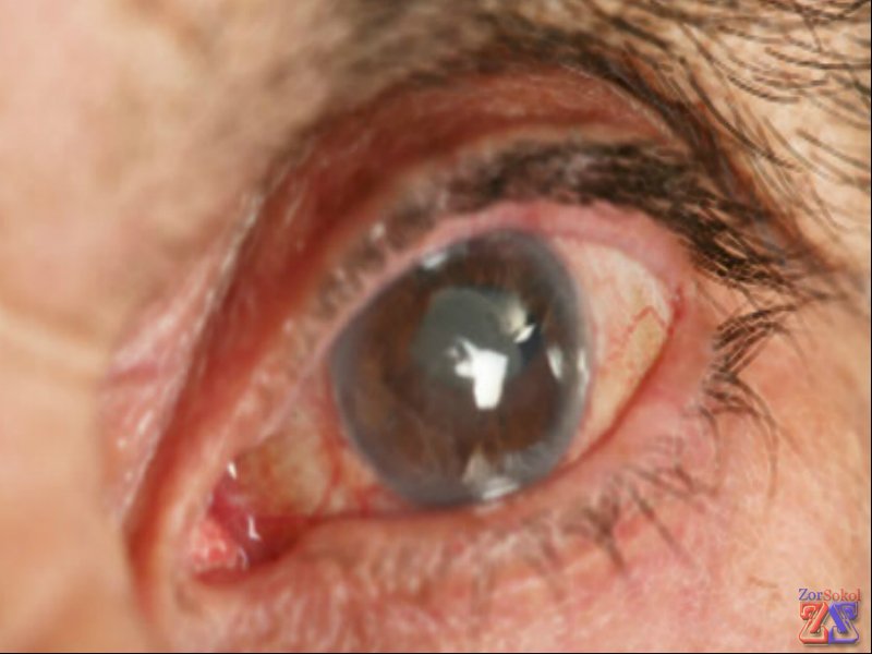 Основная причина - старость Основная причина - старость