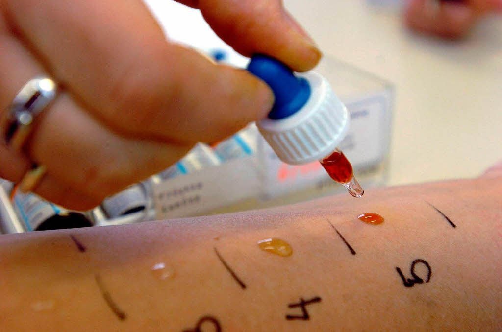 Скарификационный тест на аллерген