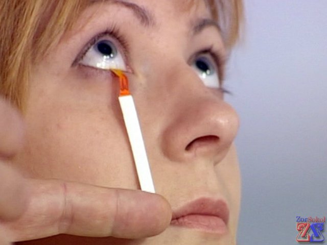 Тест на выработку слезной жидкости Тест на выработку слезной жидкости